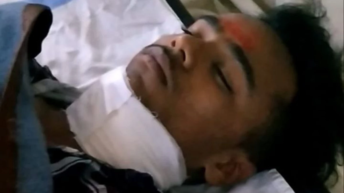 उज्जैन में चाइना डोर से नाबालिग बाइक सवार का गला कटा, हालत नाजुक