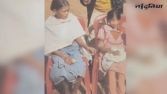 पत्थर शरीर वाली बीमार बच्ची के नाम पर क्राउडफंडिंग में हेरफेर, बाल अधिकार संरक्षण आयोग ने दिए जांच के निर्देश