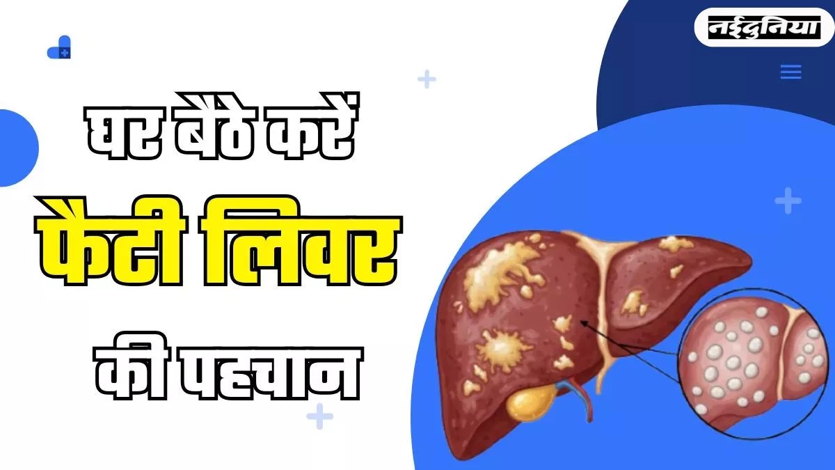 Fatty Liver Symptoms: बिना टेस्ट घर बैठे पहचानें फैटी लिवर, डॉक्टर से जानें शुरुआती लक्षण