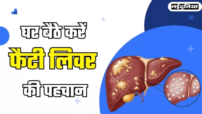 Fatty Liver Symptoms: बिना टेस्ट घर बैठे पहचानें फैटी लिवर, डॉक्टर से जानें शुरुआती लक्षण