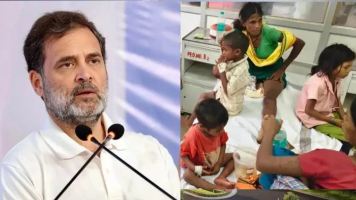 राहुल गांधी के बालाघाट दौरे से पहले एक और बच्ची की मौत, छह दिन से जिला अस्पताल में थी भर्ती