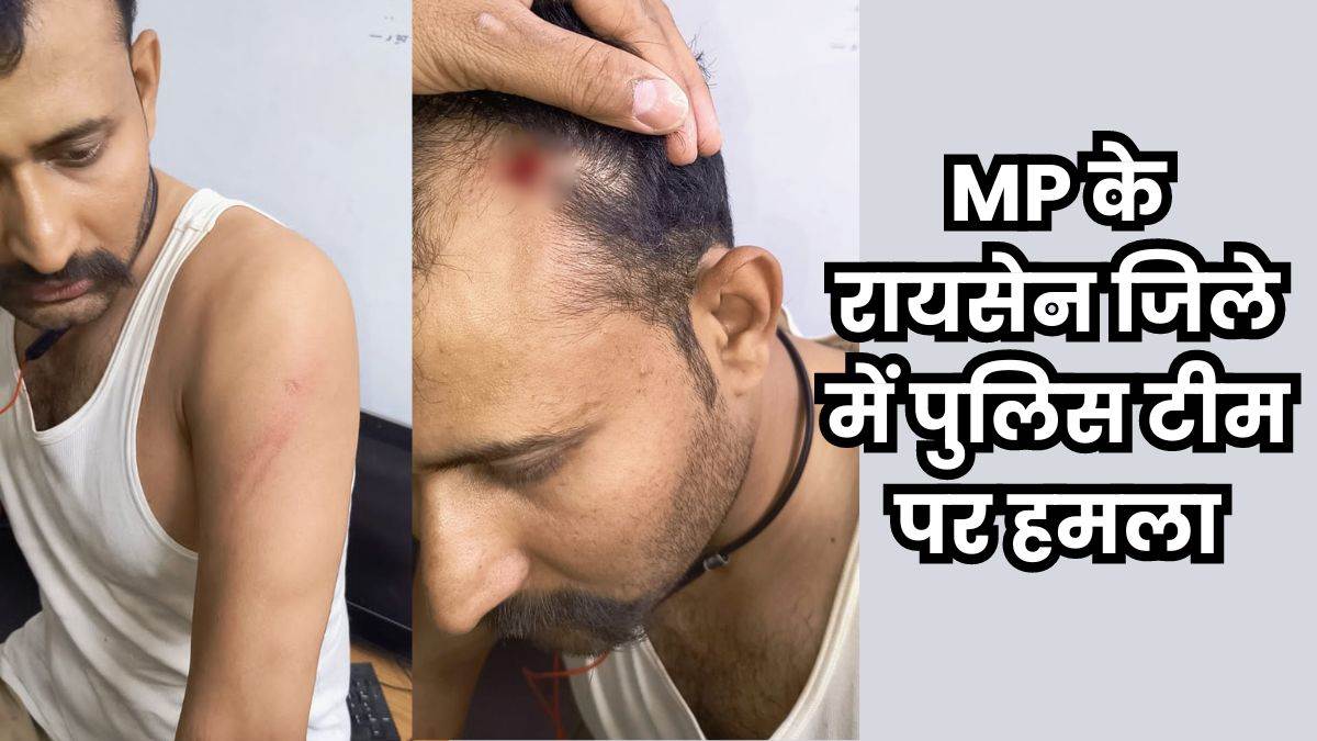 Raisen Crime News: बिजली चोरी के केस में स्थाई वारंटी को पकड़ने गई पुलिस टीम पर हमला, तीन पुलिसकर्मी घायल