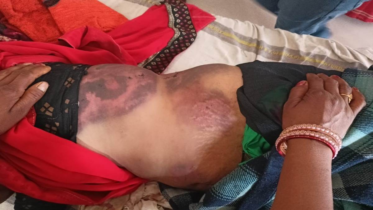 Husband beet Wife on Road: पति साली को बनाना चाहता था दूसरी पत्नी, लेकिन पहली नहीं हुई राजी तो निर्वस्त्र कर  सड़क पर पीटा