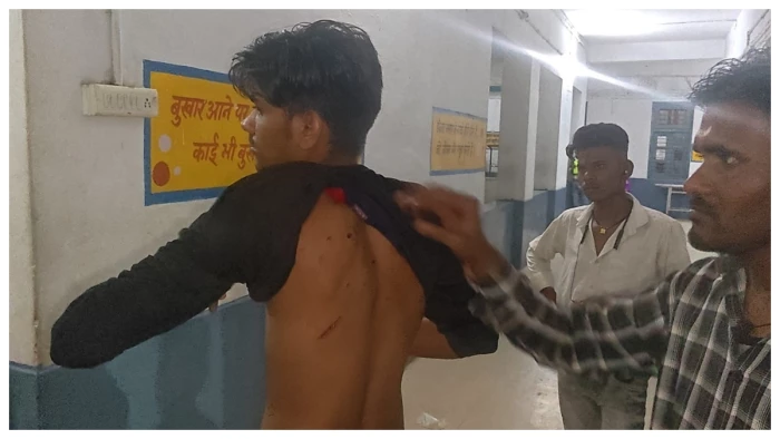 दमोह में दिनदहाड़े कपड़ा व्यापारी से लूट, पीटकर नकदी, मोबाइल व दस्तावेज छीने