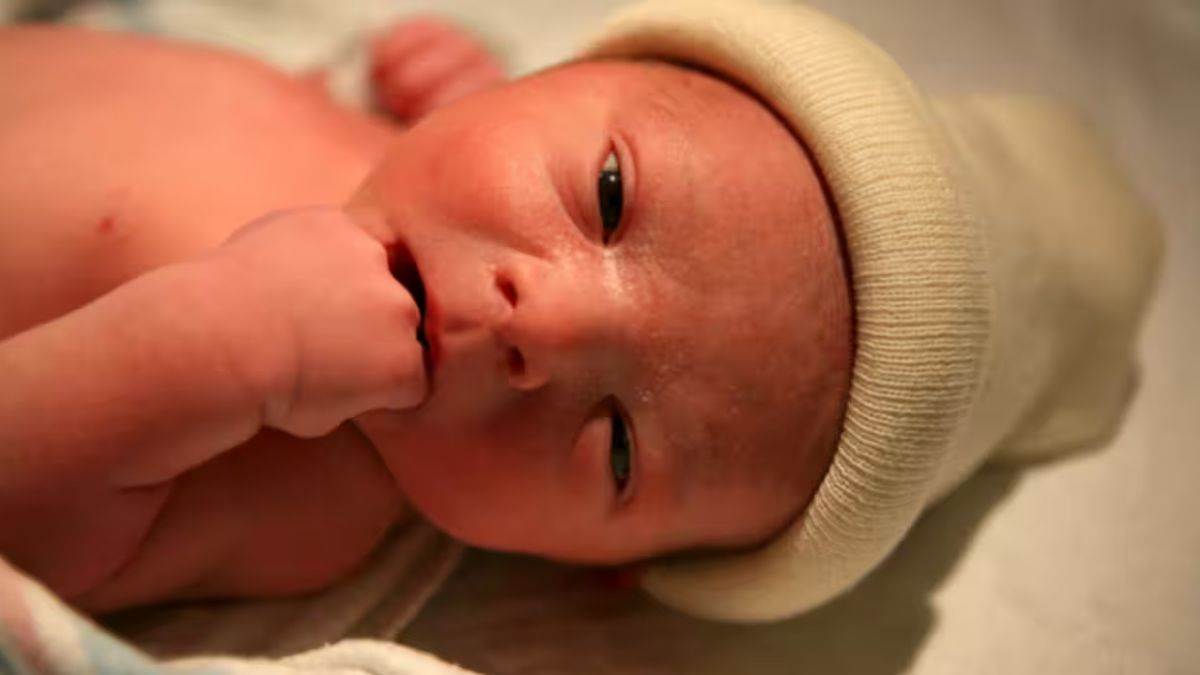 Новорожденному после. Глаза новорожденного ребенка. Новорожденные дети опухшие.
