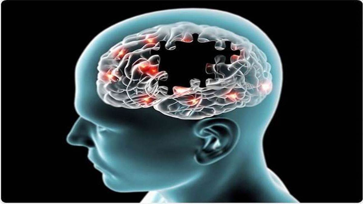 अल्जाइमर का पता लगाएगी IIT इंदौर की AI एल्गोरिदम, शुरुआती दौर में ही कर लेगी चिह्नित