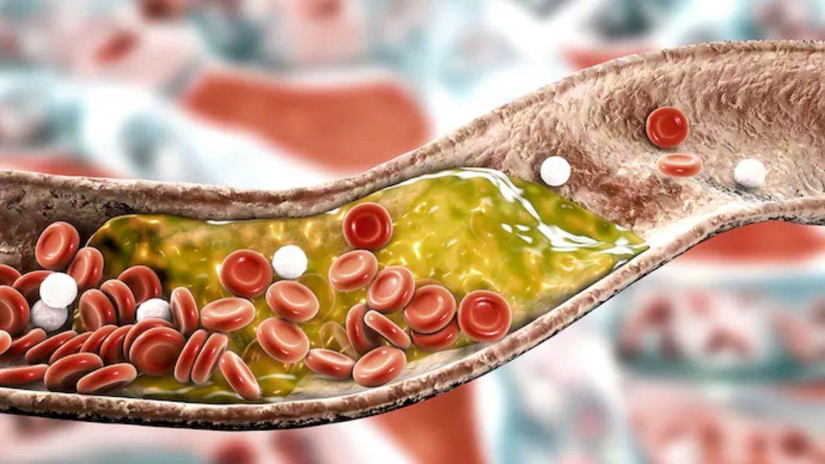 Low Cholesterol Foods: कोलेस्ट्रॉल को कम करना है तो इन चीजों की डाल लें आदत, नहीं रहेगा हार्ट अटैक का खतरा