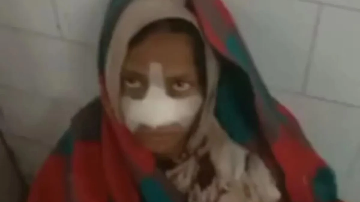 पति से पैसे मांगने पर सौतन ने किया जानलेवा हमला... महिला की काटी नाक