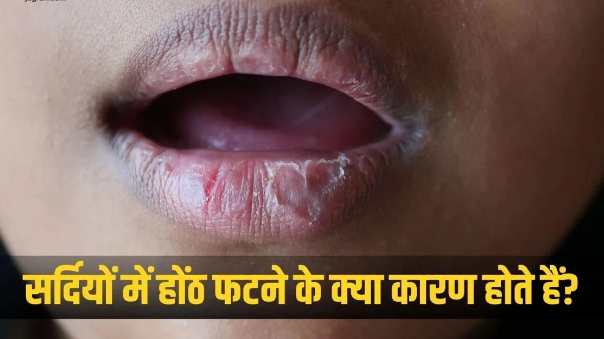 Winter Lip Care: सर्दियों में ही क्यों ज्यादा फटते हैं होंठ, जानिए कारण... सॉफ्ट और हेल्दी रखने के लिए फॉलो करें ये टिप्स