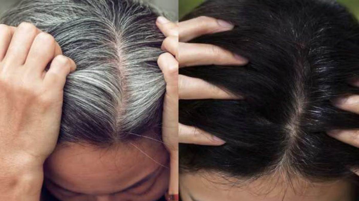 10 Common Hair Problems And How To Fix Them  SkinKraft