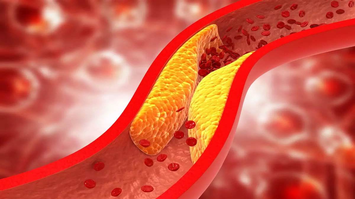 High Cholesterol: रोज पिएं ये 3 जूस, कंट्रोल हो जाएगा बढ़ा हुआ कोलेस्ट्रॉल