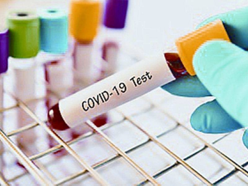 Corona test: कोरोना जांच के लिए एंटीजन, ट्रूनाट और आरटीपीसीआर की सुविधा उपलब्ध