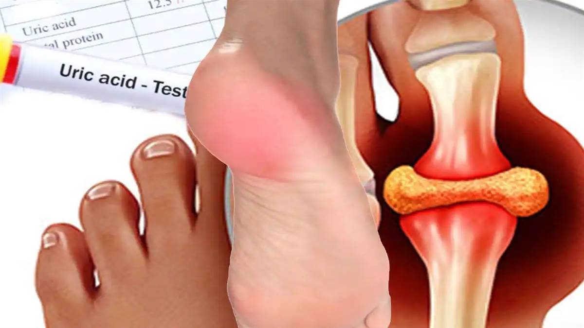 Uric Acid कम करना चाहते हैं तो रात में कभी न करें इन चीजों का सेवन If