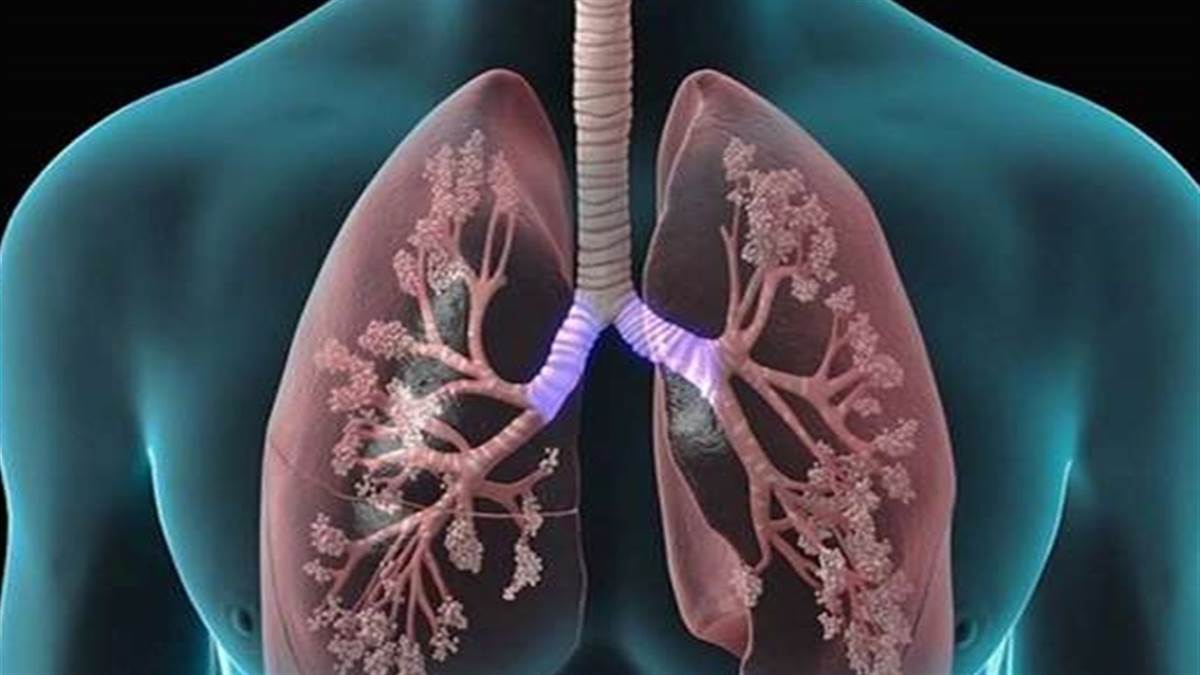 Cleaning lungs फेफड़ों को इस तरह करेंगे साफ, तो हर संक्रमण से होगा