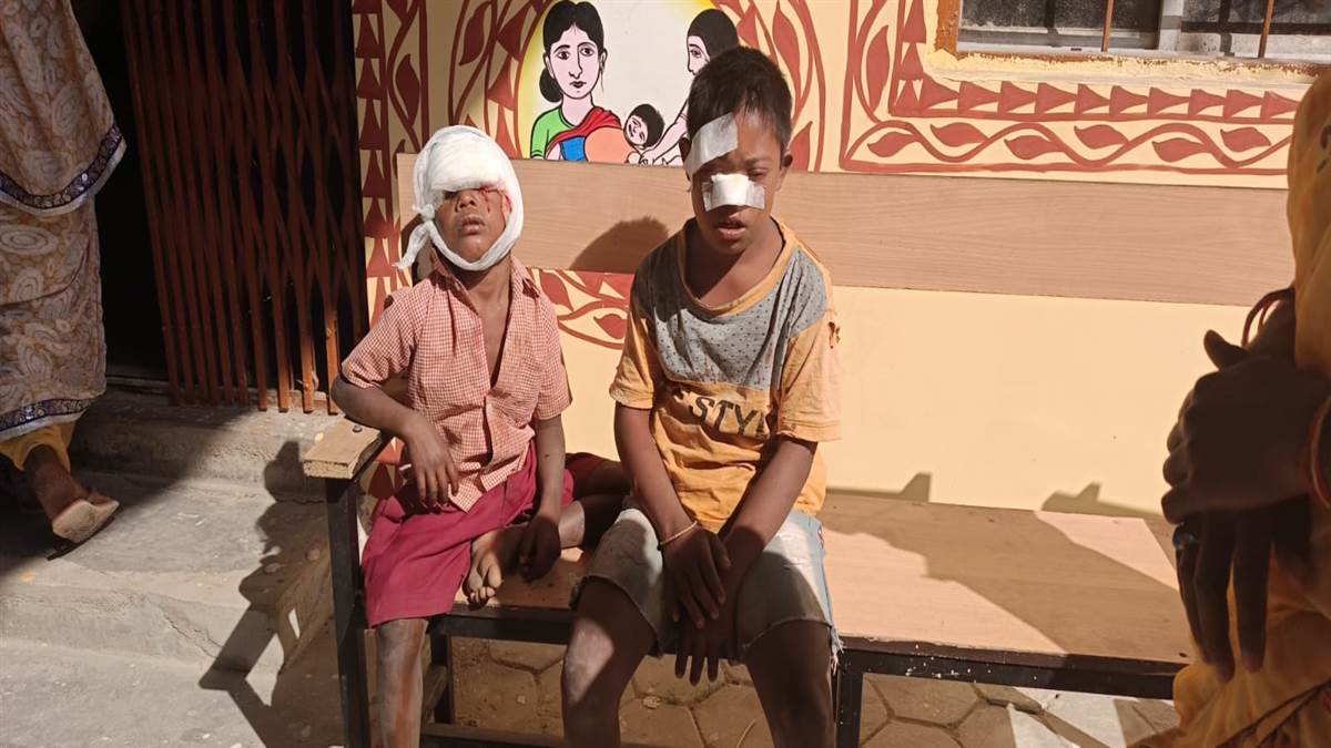 आवारा पागल कुत्ते के हमले 12 घायल