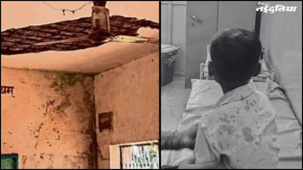 अब एमपी में गिरा स्कूल की छत का प्लास्टर, छात्र के सिर से इतना खून बहा कि यूनिफार्म हो गई लाल