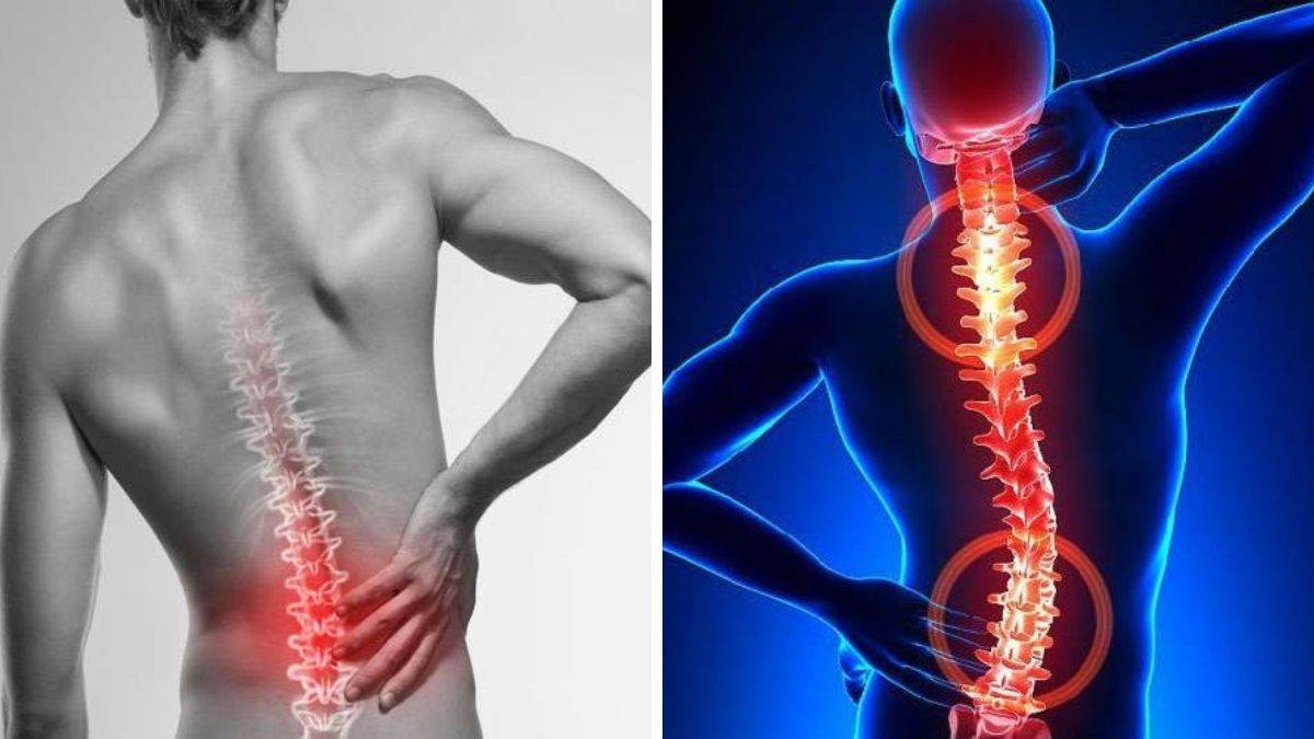 Health: इन गलतियों की वजह से होती है कमर दर्द की समस्या, जानें इसके कारण और उपाय