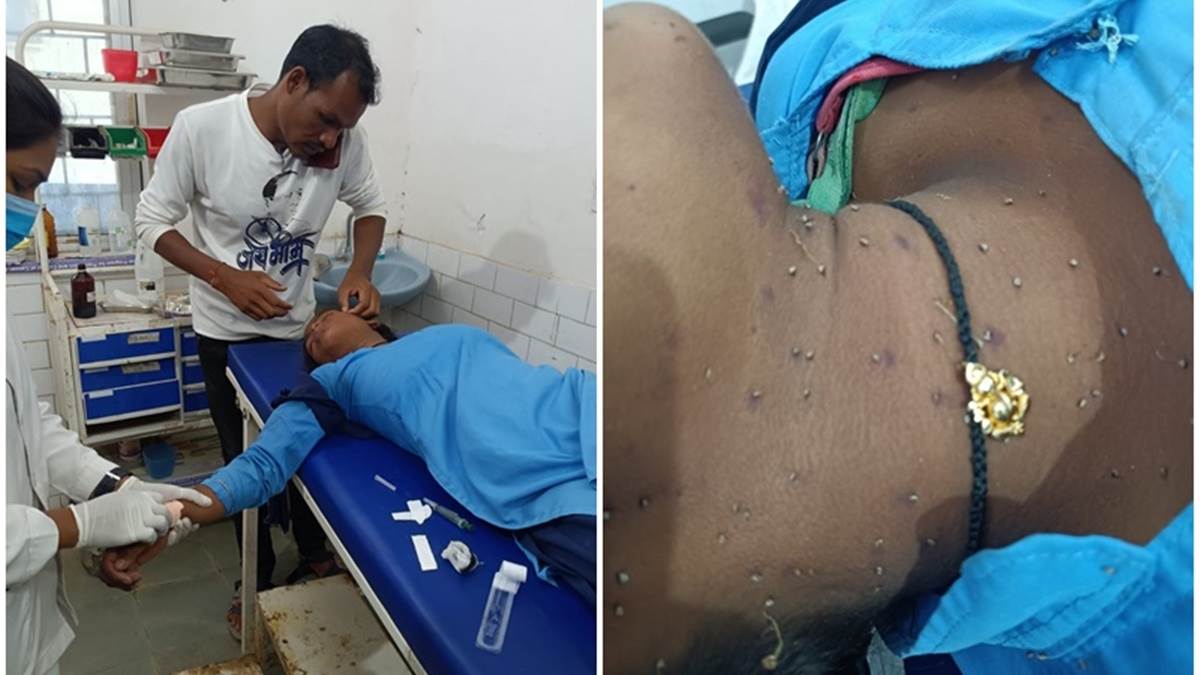 कोंडागांव में अजीबो-गरीब घटना, परीक्षा देने जा रही 10वीं की छात्रा पर मधुमक्‍खियों ने किया हमला, छूटा पेपर