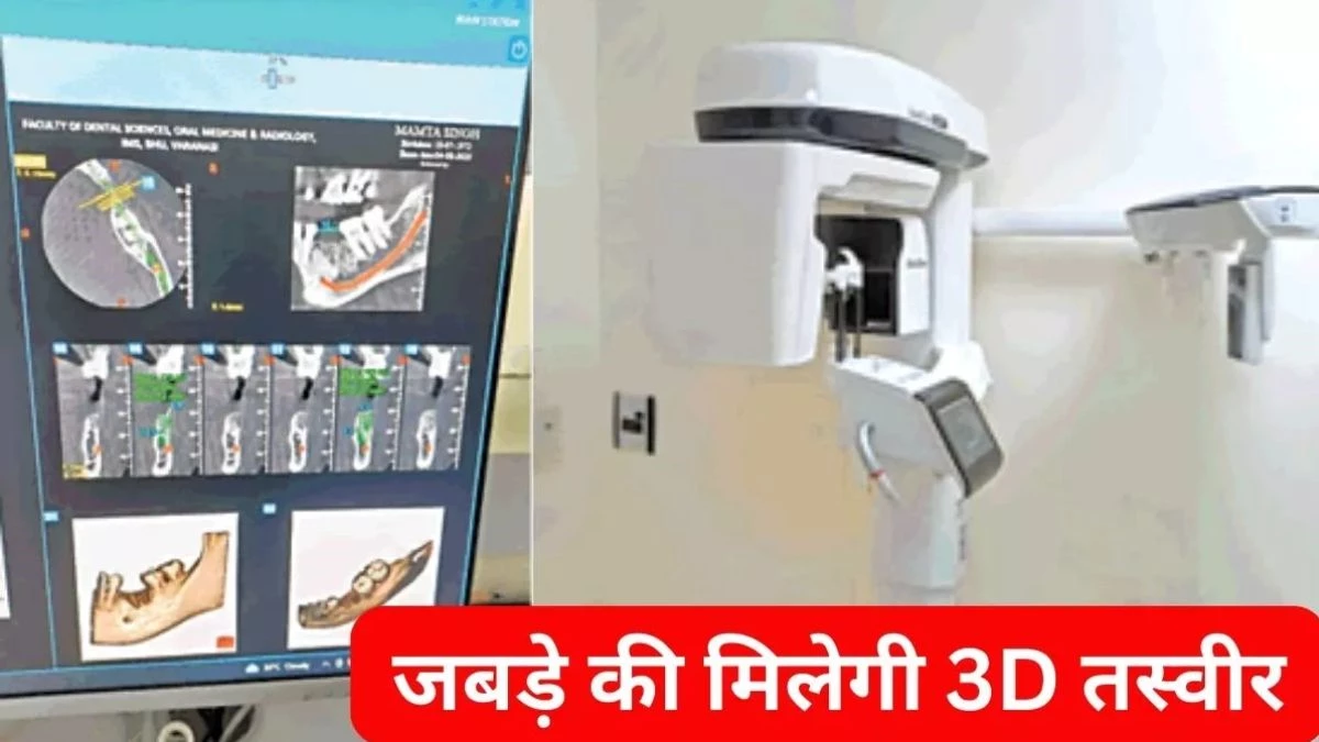 दांतों की सड़न, फ्रैक्चर का अब लगेगा सटीक पता… इंदौर के दंत चिकित्सालय में आ रही सीबीसीटी मशीन