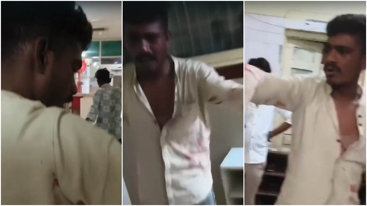 कटनी जिला अस्पताल में देर रात घुसा नशेड़ी, एसएनसीयू वार्ड का कांच फोड़ मचाया हंगामा; दहशत में मरीज