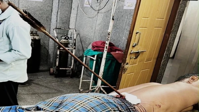 रायपुर में आंबेडकर अस्पताल के डॉक्टरों का कमाल, पीठ के आर-पार हुए तीर को निकालकर बचाई जान