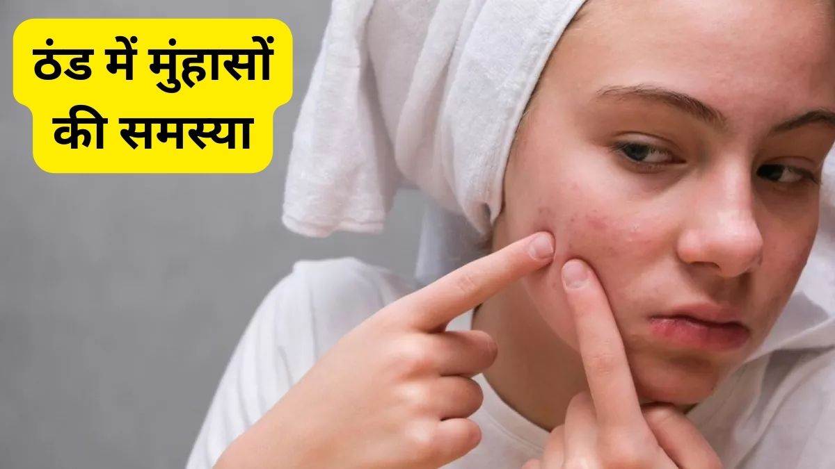 Pimples Downside in Winter: सर्दियों में बढ़ जाती है मुंहासों की समस्या, इन बातों की रखें सावधानी