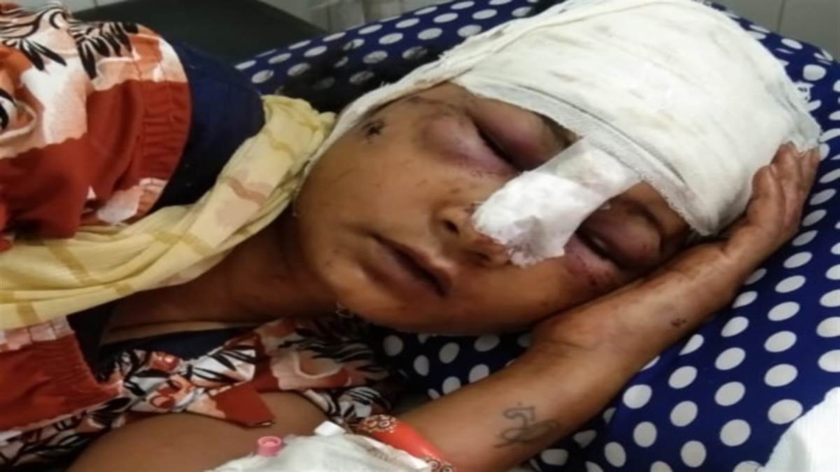 Bhopal Crime News: हैवान बना शराबी पति, पत्नी पर सरेराह हथौड़े से किए ताबड़तोड वार