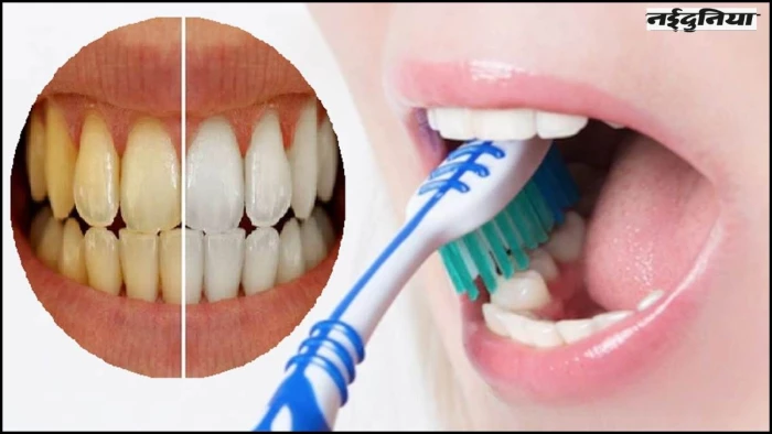 Monsoon Teeth Care: बरसात में मुस्कान न हो मंद, इसलिए बनें अक्लमंद, इस मौसम दांतों की करें खास देखभाल