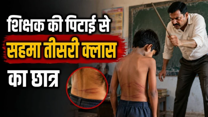 शिक्षक की पिटाई से सहमा तीसरी क्लास का छात्र, नहीं जा रहा स्कूल, कमर पर मिले चोट के निशान, थाने पहुंचा मामला