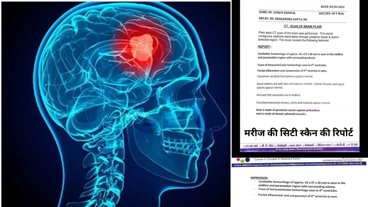 न दुर्घटना हुई और न ही मारपीट फिर भी ब्रेन हेमरेज, डीजे की तेज आवाज पर संदेह,मरीज रायपुर रिफर