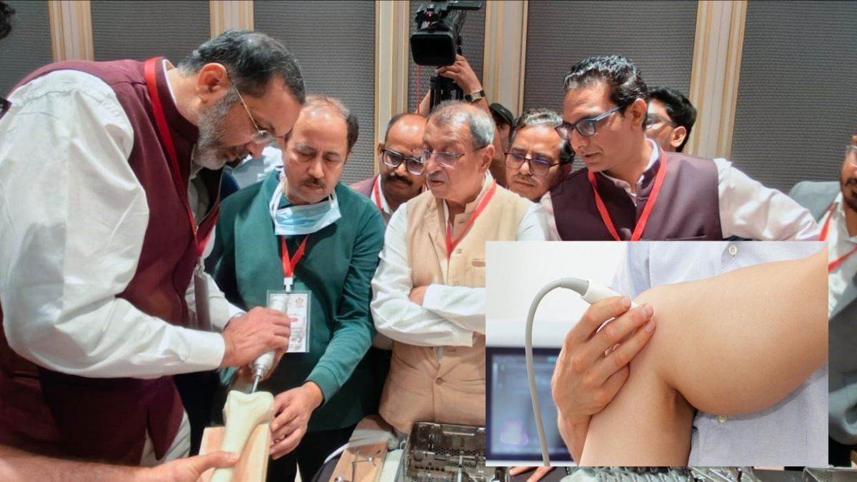 मेडिकल काॅलेज जबलपुर में यूनिकान्डिलर नी रिप्लेसमेंट अब संभव, मरीजों को मिलेगी राहत