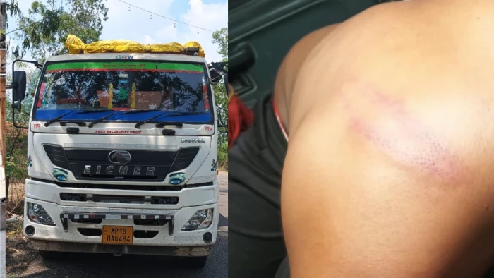 सतना में कुत्ते की मौत पर बंदूकधारियों ने ट्रक ड्राइवर को पीटा, जंगल में भागकर बचाई जान