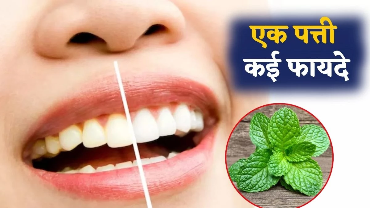 बासी मुंह चबांए 3 पत्तियां, चांदी की तरह चमकेंगे दांत