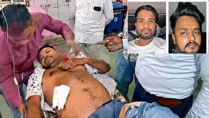 सरेआम कार सवार बदमाशों ने युवक के पेट में मारी गोली, फायरिंग कर भाग निकले; गंभीर घायल