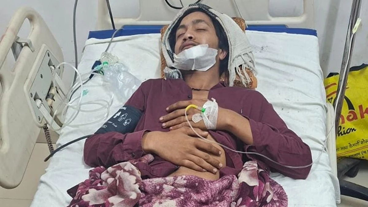 रतलाम में चले चाकू, चाय पीने कैफे पहुंचे किशोर पर नाबालिगों ने किया वार