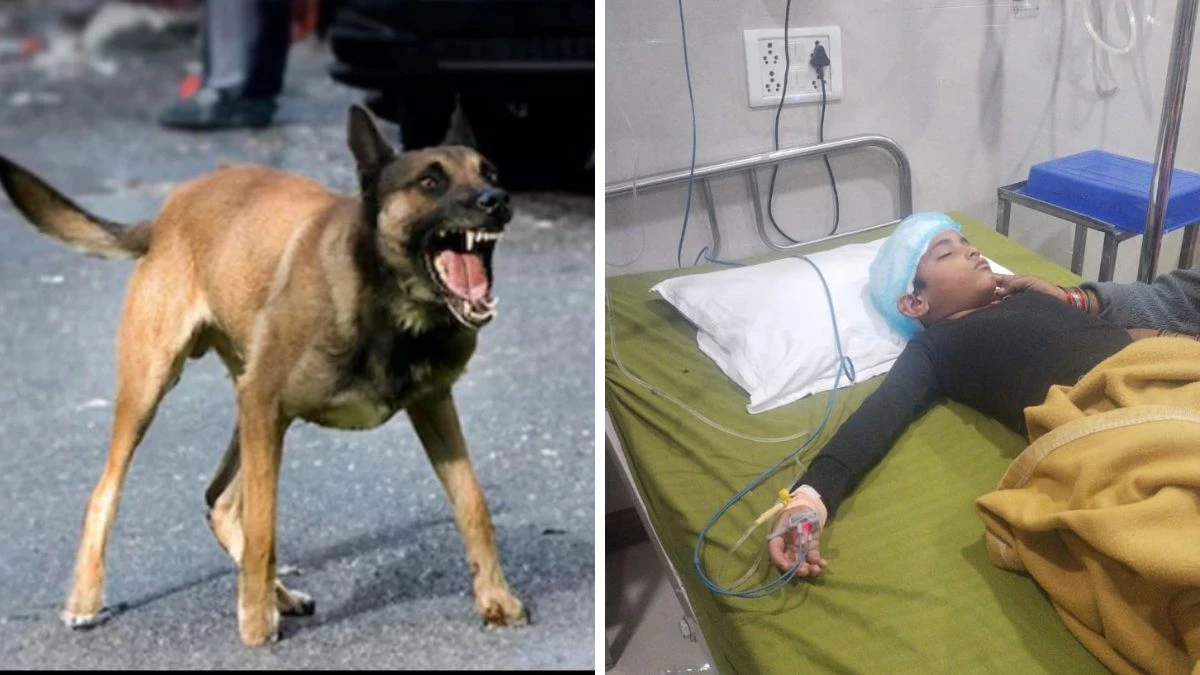 MP में घर के बाहर साइकिल चला रहे मासूम को श्वान ने नोचा, सिर में आए 22 टांके, ICU में भर्ती... मालिक पर मामला दर्ज