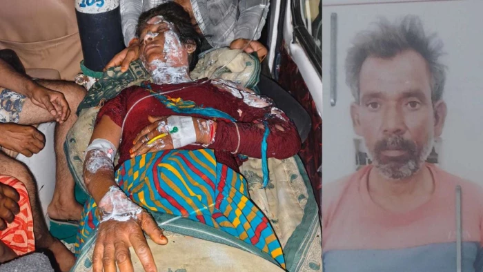 विवाद के बाद देवर ने भाभी को पेट्रोल डालकर जिंदा जलाया; हालत नाजुक, आरोपी गिरफ्तार