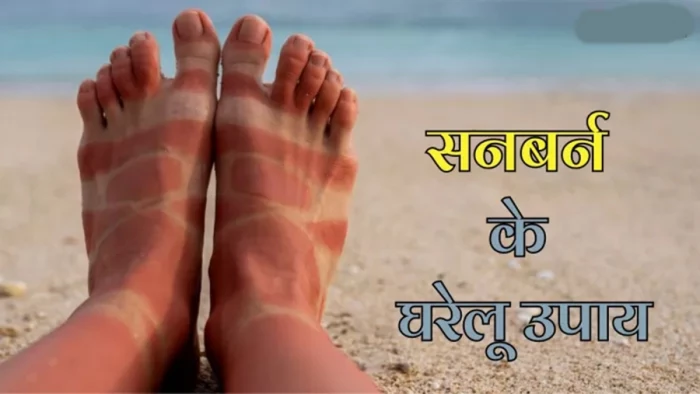 सितंबर की तेज धूप कर रही है परेशान, जान लीजिये UV किरणों से बचाव के आसान तरीके