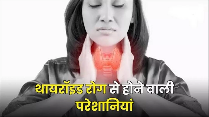 यह मर्ज इन दिनों बेहद आम हो गया है, थायराइड को लेकर 8 सवाल और उनके जवाब