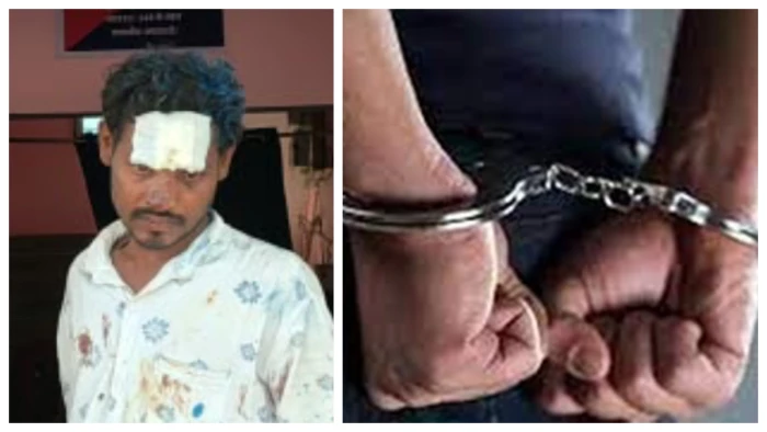 जांजगीर: पत्नी को जिंदा जलाने की कोशिश, शराब के नशे में तारपीन तेल डालकर लगाई आग