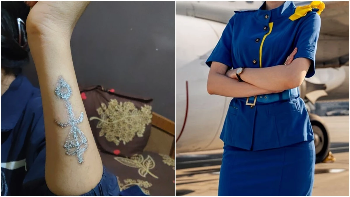 टैटू हटवाने गई युवती का हुआ गलत लेजर ट्रीटमेंट, एयर होस्टेस बनने का सपना टूटा
