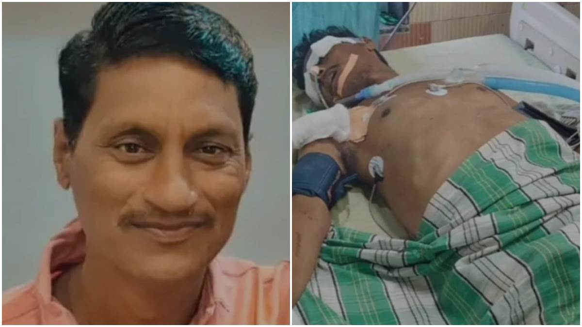 छिंदवाड़ा सिमरिया बस हादसा: घटना के 19 दिनों बाद कंडक्टर ने तोड़ा दम, मौत का आंकड़ा हुआ 11,