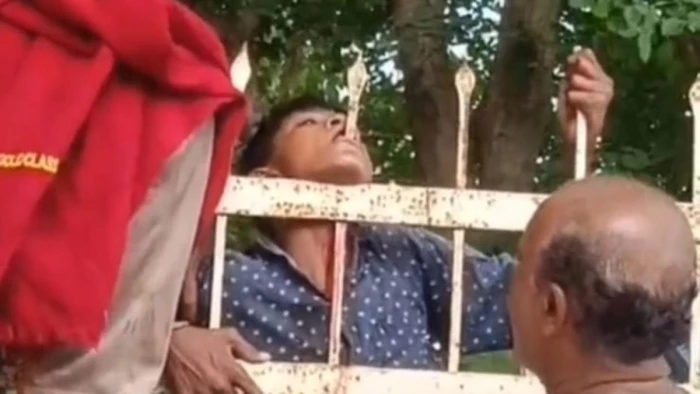 खेल-खेल में मौत के मुहाने पर पहुंचा किशोर, गले के आरपार हुआ सीआईएसएफ की बाउंड्रीवॉल का नुकीला सरिया