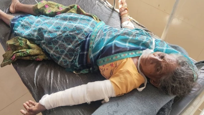 भगवान महाकाल के दर्शन के लिए कतार में लगी महिला भीड़ में दबी, हाथ हुआ फ्रैक्चर