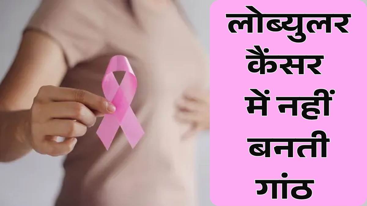 AIIMS Bhopal: स्तन कैंसर का यह प्रकार है खतरनाक, गांठ न बनने के बावजूद इन लक्षणों से करें पहचान