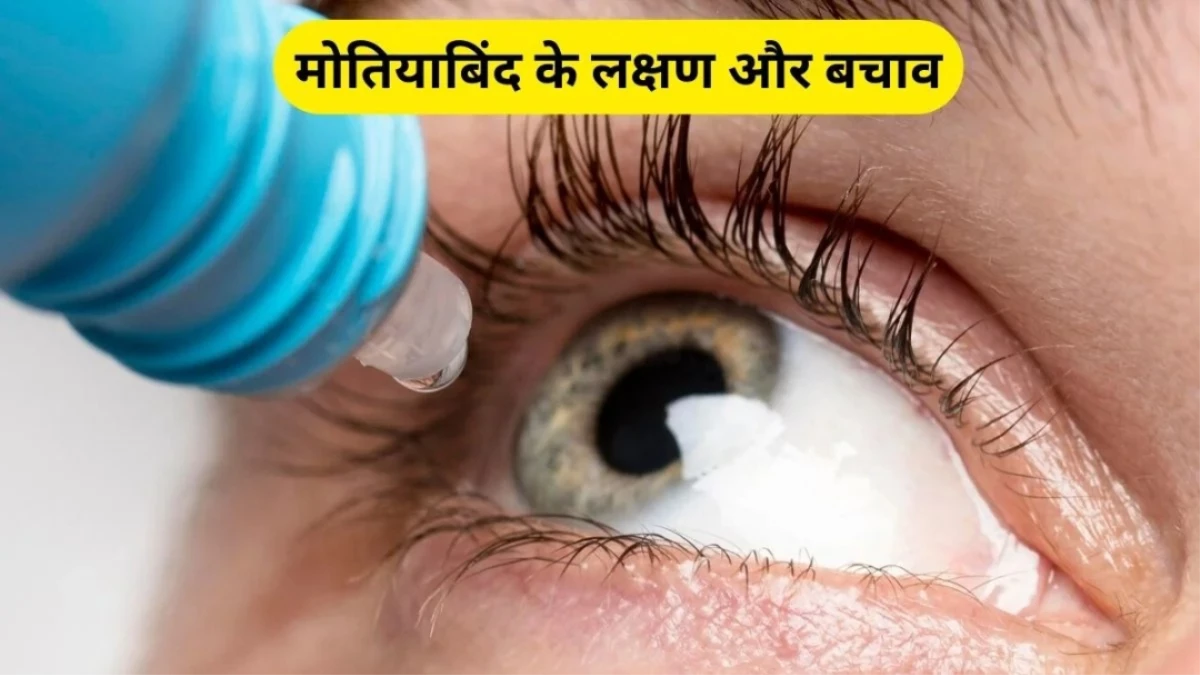 मोतियाबिंद की शुरुआत से पहले दिखते हैं ये 5 लक्षण, समय रहते हो जाएं सावधान; वरना जा सकती है नजर