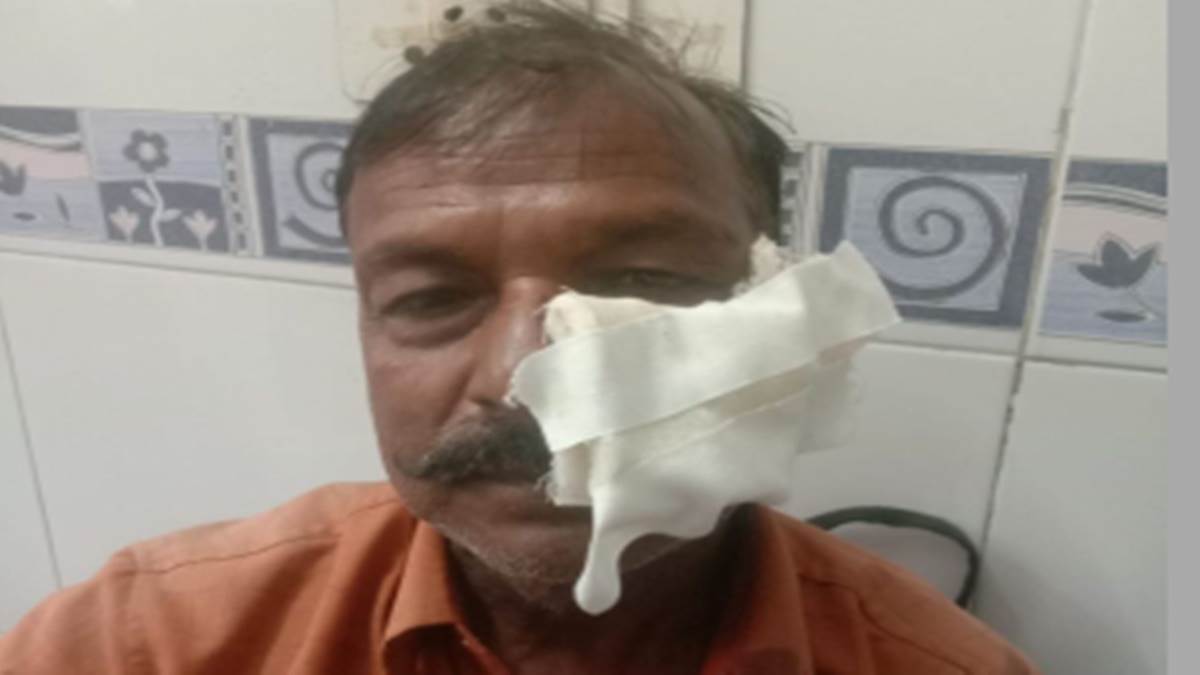Ujjain News : उज्‍जैन में आवारा कुत्तों ने दो लोगों पर किया हमला, दोनों की नाक काटी
