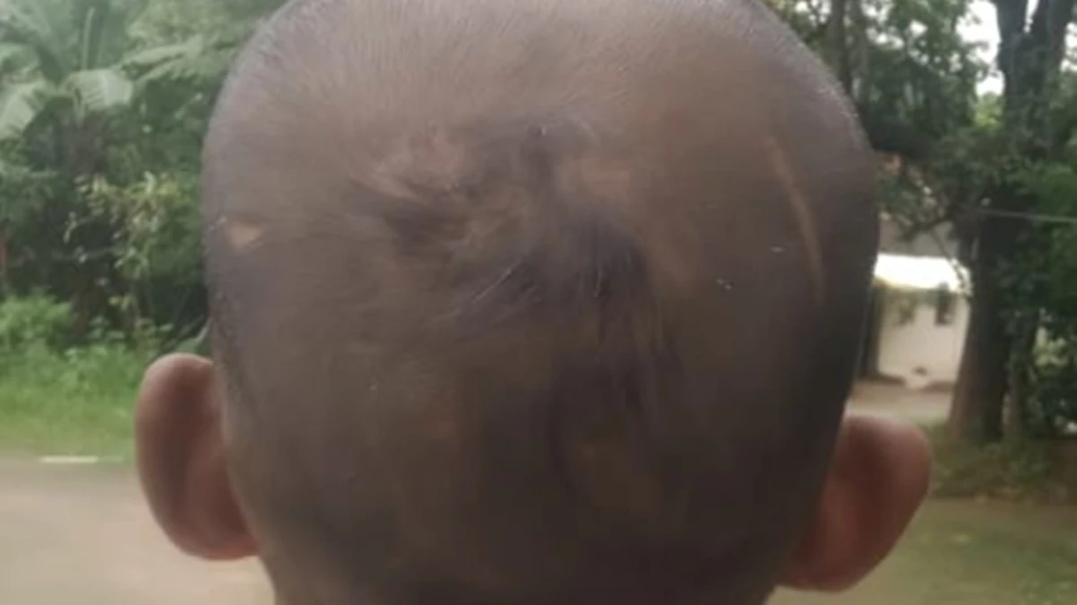 मध्य प्रदेश की शाहपुर पुलिस पर ब्राह्मण युवक को पीटने और चोंटी उखाड़ने का आरोप, हंगामा