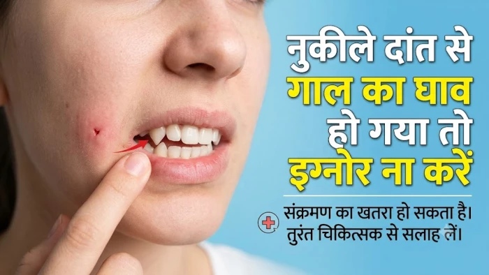 नुकीले दांत से गाल का घाव हो गया तो इग्नोर ना करें, हार्ट तक पहुंच सकते हैं बैक्टीरिया