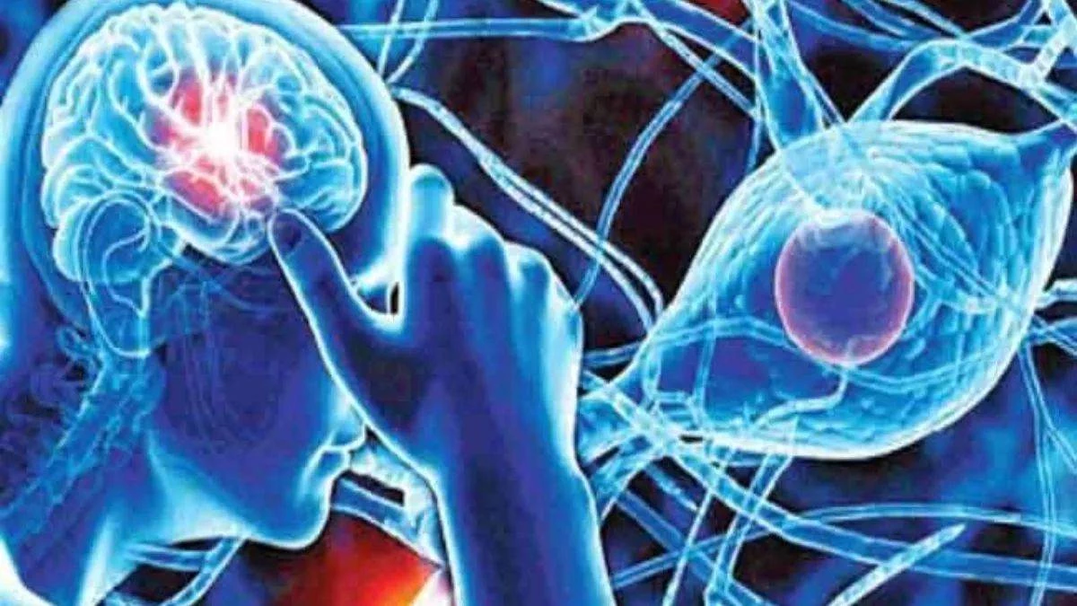 World Epilepsy Day: मिर्गी है तो घबराएं नहीं, एम्स भोपाल में माइनर सर्जरी से बेहतर उपचार उपलब्ध